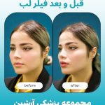 کلینیک زیبایی آرشین شیراز
