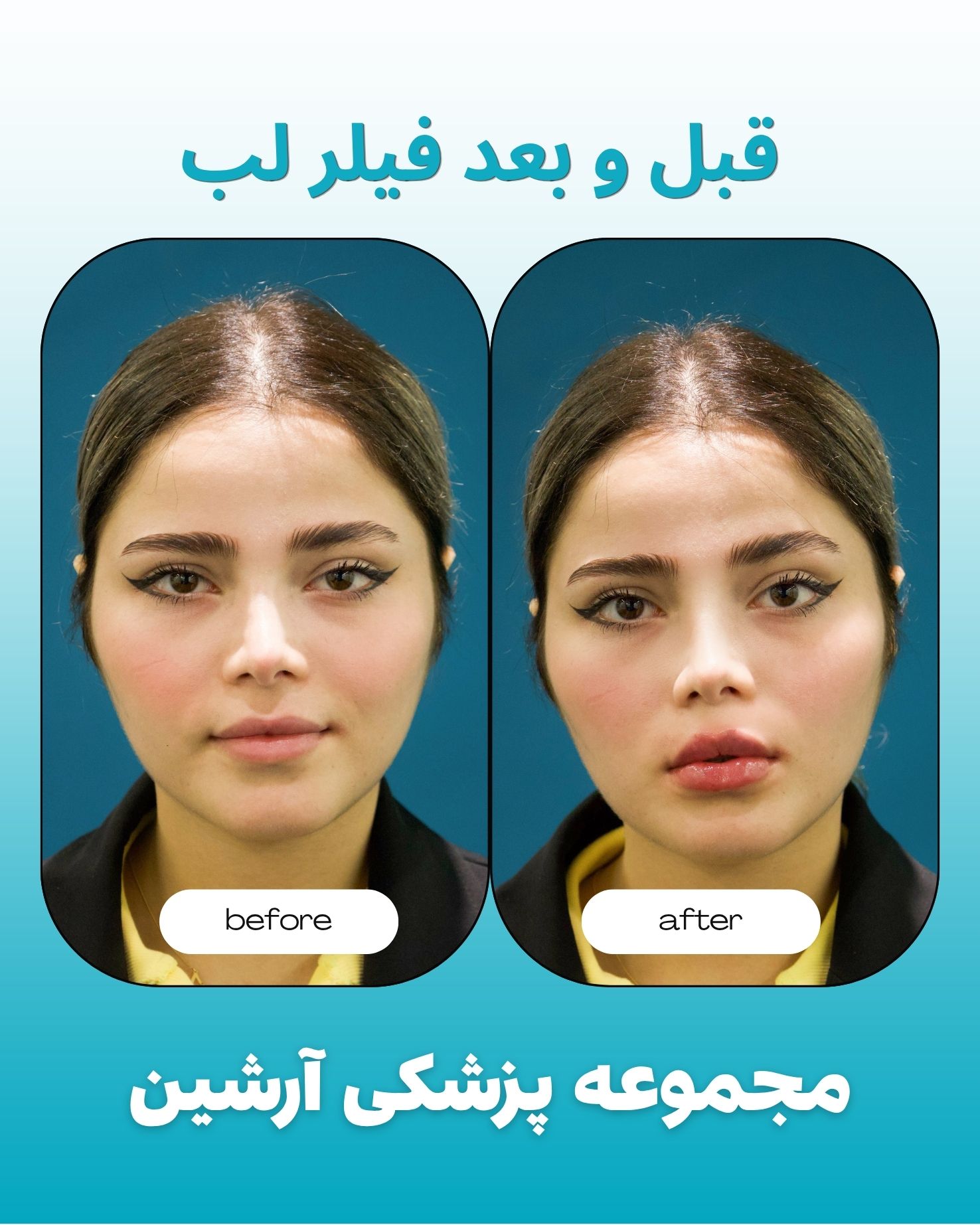نمونه خدمات زیبایی صورت در کلینیک زیبایی آرشین شیراز-مشاغل ممتاز