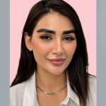 کاشت ابرو فرشته امینی در شیراز