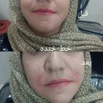 مطب زیبایی سایماه در کرمان