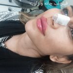 مطب زیبایی سایماه در کرمان
