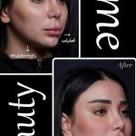 کلینیک زیبایی کام بیوتی اصفهان