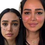 کلینیک زیبایی کام بیوتی اصفهان