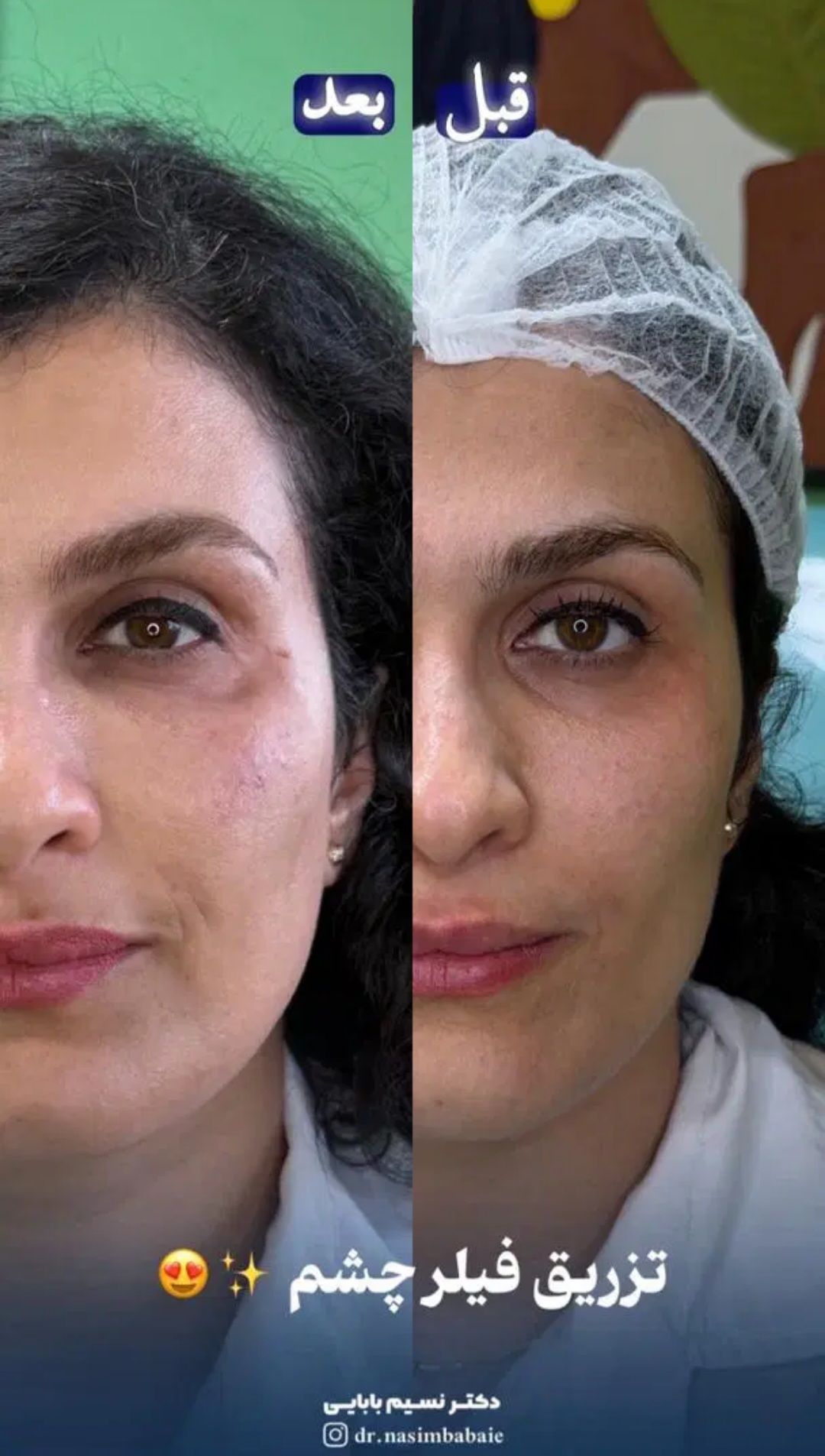 بهترین مرکز خدمات زیبایی و پوست در کلینیک زیبایی نسیم در آمل -مشاغل ممتاز