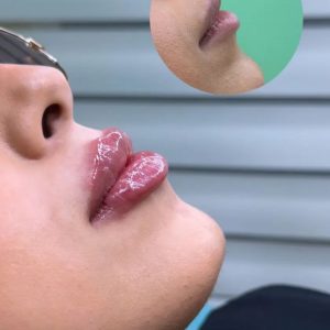 کلینیک زیبایی نسیم در آمل ارائه دهنده خدمات تخصصی پوست و جوانسازی -مشاغل ممتاز