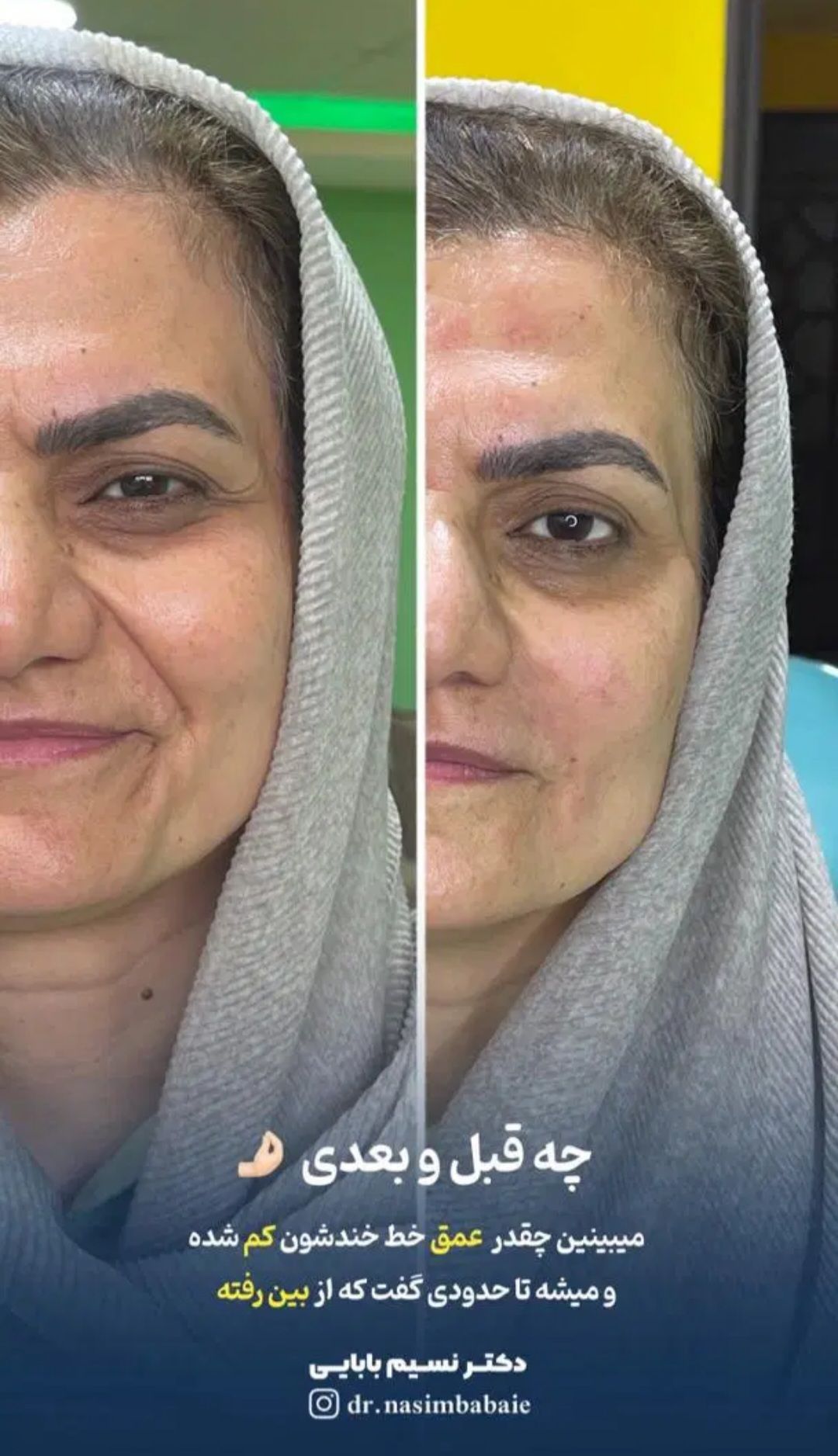 خدمات جوانسازی پوست در کلینیک زیبایی نسیم در آمل -مشاغل ممتاز