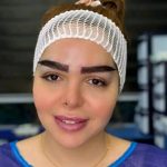 کاشت ابرو فرشته امینی در شیراز