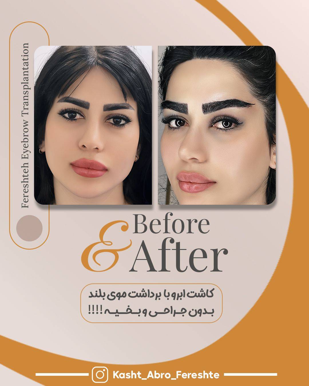کاشت ابرو فرشته امینی در شیراز با طراحی طبیعی و تراکم بالا -مشاغل ممتاز