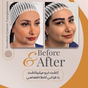 کاشت ابرو فرشته امینی در شیراز-مشاغل ممتاز