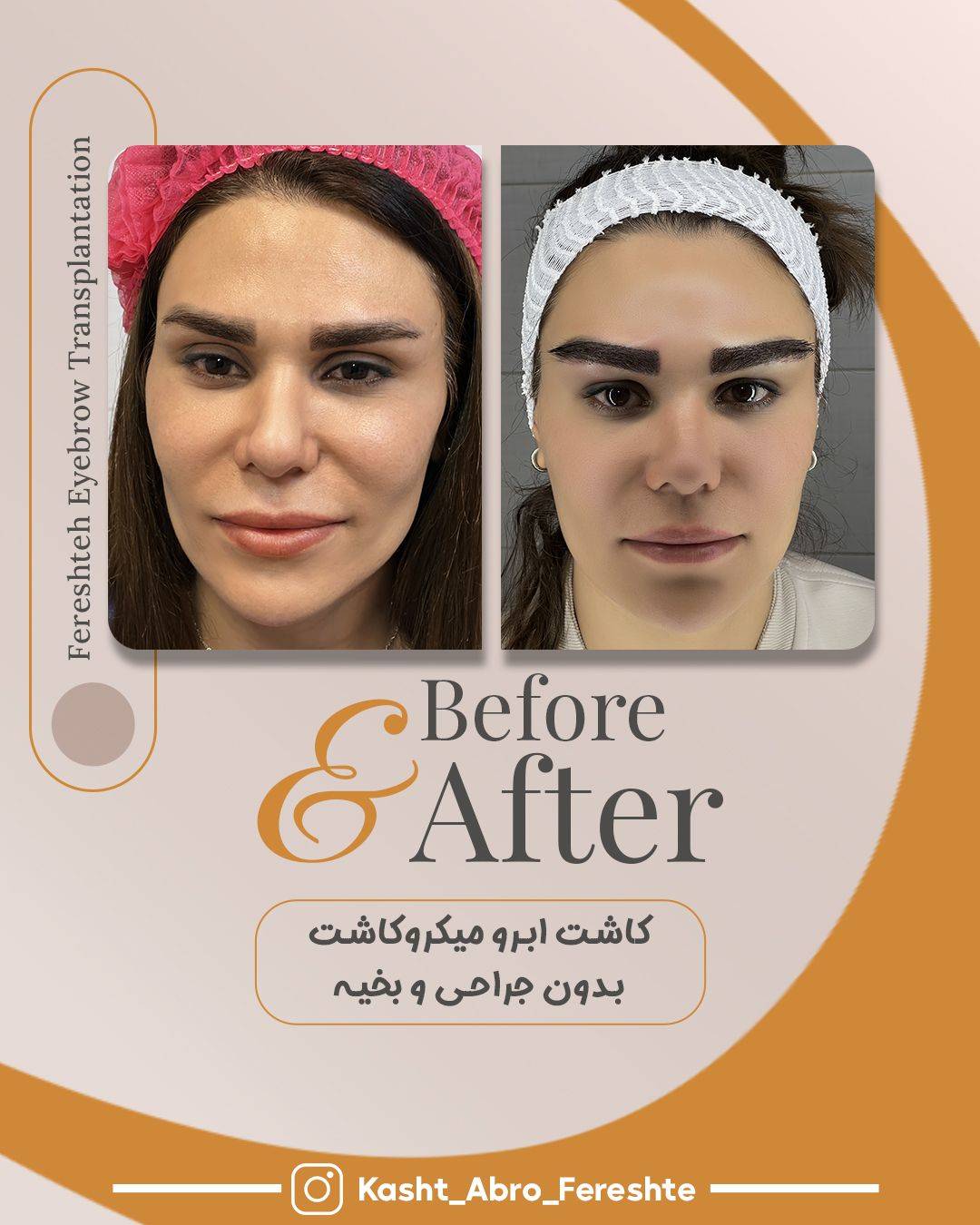 بهترین مرکز کاشت ابرو در شیراز فرشته امینی -مشاغل ممتاز