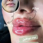 مجتمع پزشکی آوین فولادشهر
