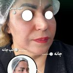 مجتمع پزشکی آوین فولادشهر
