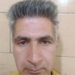 مرکز کاشت مو‌ کاکویی در کرمان