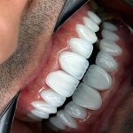 کلینیک دندانپزشکی دکتر حجت اله خاک نجاتی در تهران