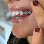 کلینیک دندانپزشکی دکتر حجت اله خاک نجاتی در تهران