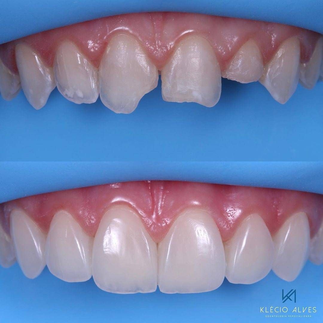 قالبگیری دقیق دیجیتال در کلینیک دندانپزشکی دکتر حجت اله خاک نجاتی در تهران_مشاغل ممتاز