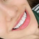 دندانپزشکی دکتر فرشاد عبدی خرم‌آباد