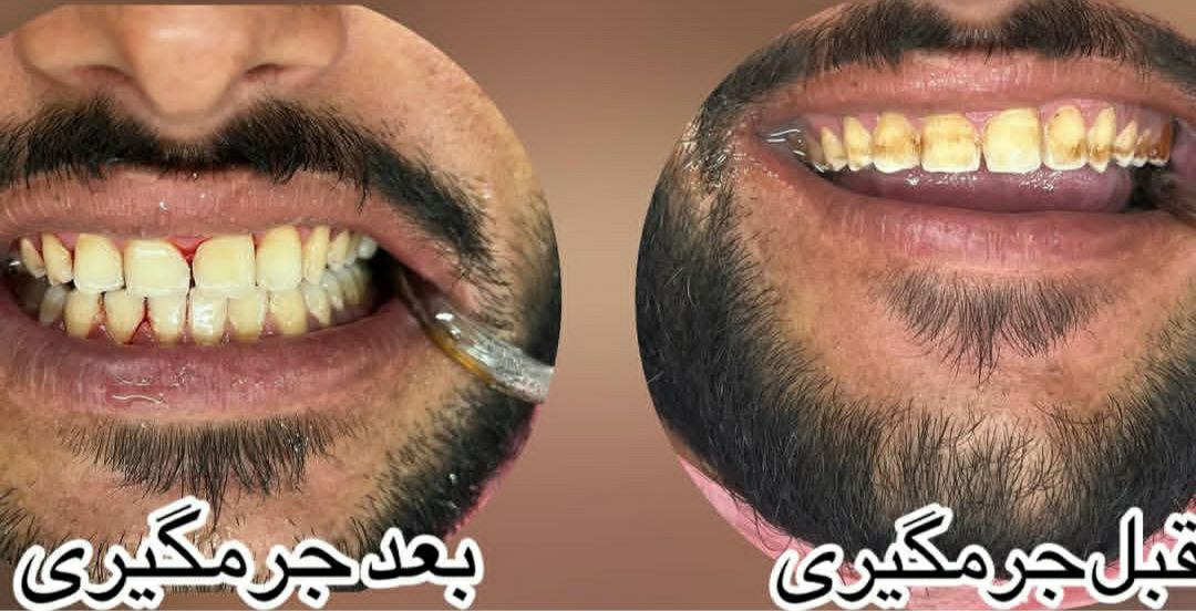 خدمات کامل دندانپزشکی در مطب دندانپزشکی دکتر حسین سالاری کرمان-مشاغل ممتاز