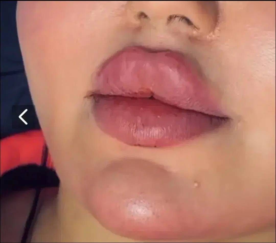 فیلر چانه کلینیک زیبایی دلورا با خدمات کامل -مشاغل ممتاز