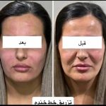 کلینیک زیبایی دلورا غرب تهران