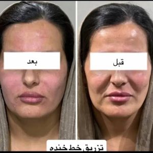 کلینیک زیبایی دلورا غرب تهران ارائه خدمات تخصصی پوست و زیبایی -مشاغل ممتاز