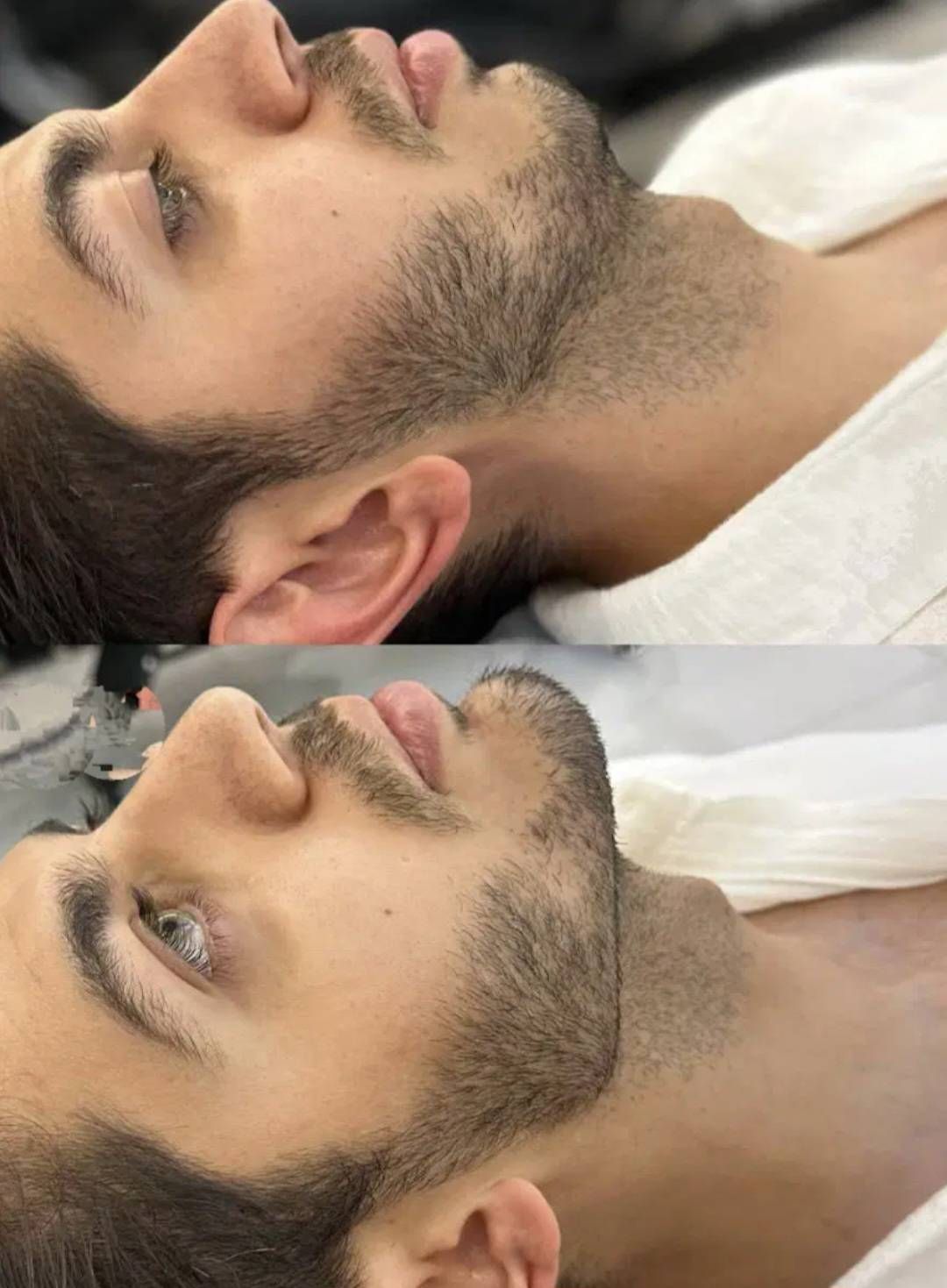 زاویهسازی صورت و کانتورینگ حرفهای در کلینیک زیبایی دلورا غرب تهران -مشاغل ممتاز