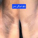 کلینیک زیبایی دلورا غرب تهران