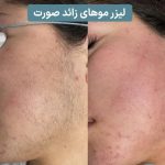 کلینیک زیبایی آهو در تبریز