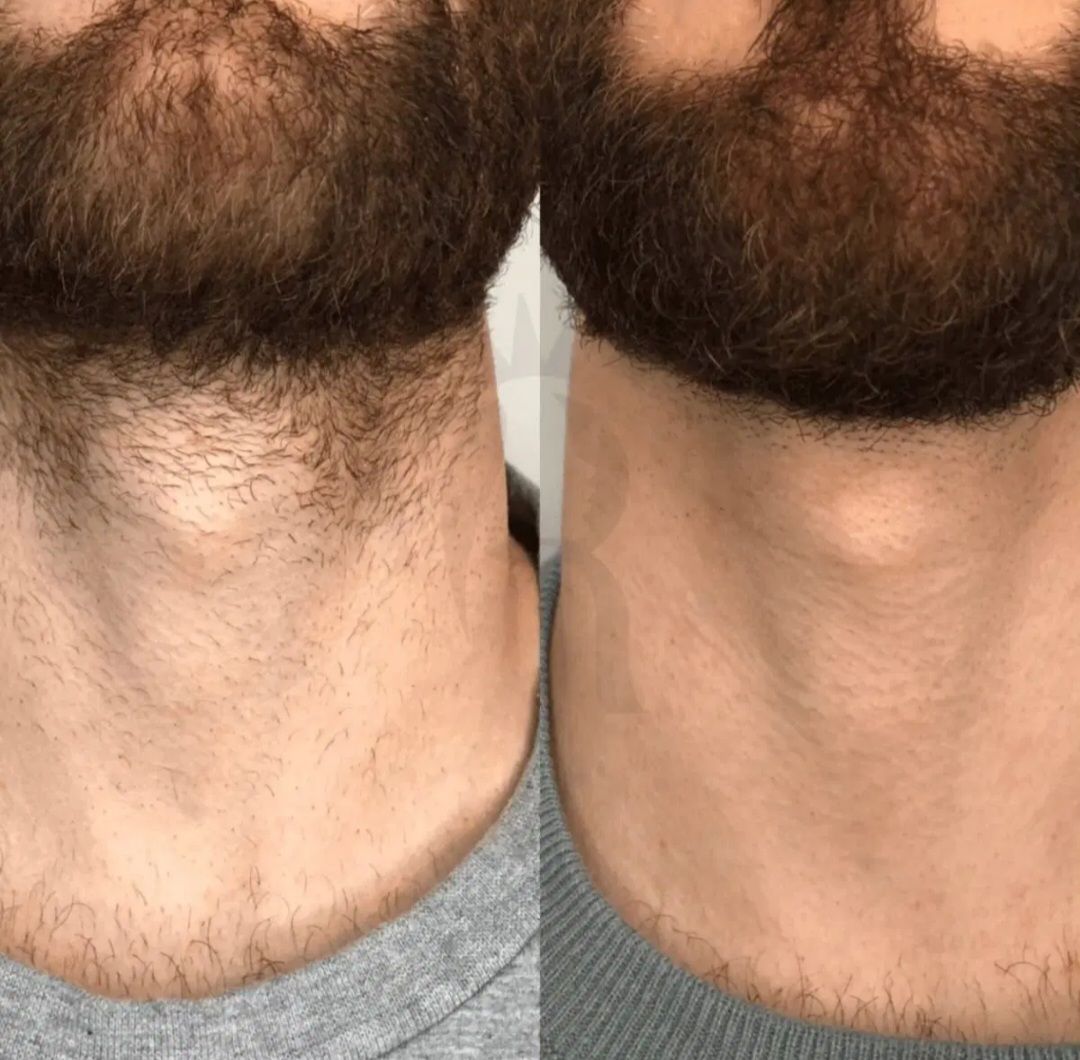 مرکز تخصصی مراقبت پوست و خدمات زیبایی در تبریز کلینیک آهو_مشاغل ممتاز