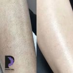 کلینیک زیبایی آهو در تبریز