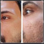 کلینیک زیبایی آهو در تبریز