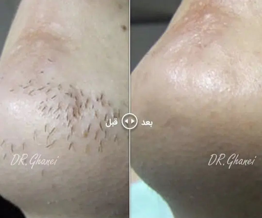 بهترین کلینیک زیبایی در تبریز برای لیزر پاکسازی و جوانسازی پوست آهو_مشاغل ممتاز
