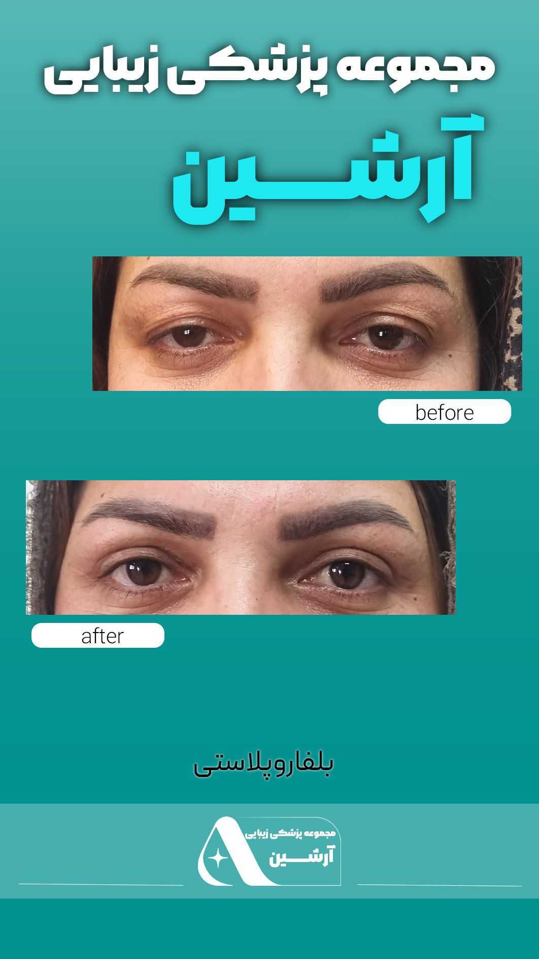 نمونه خدمات زیبایی صورت در کلینیک زیبایی آرشین شیراز-مشاغل ممتاز