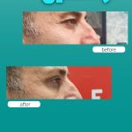 کلینیک زیبایی آرشین شیراز