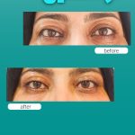 کلینیک زیبایی آرشین شیراز