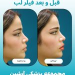 کلینیک زیبایی آرشین شیراز
