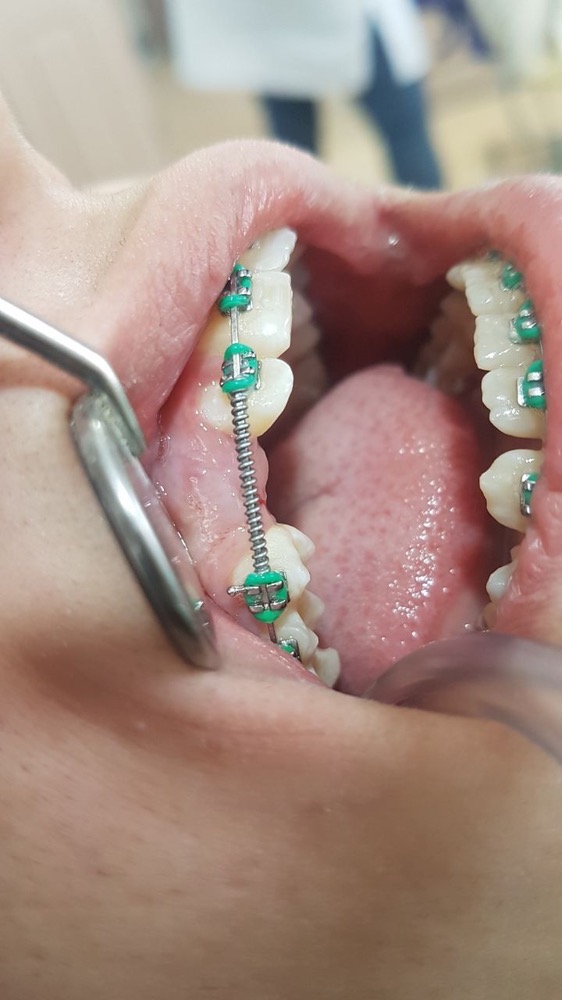 ارتودنسی دندانپزشکی دکتر علی پور در تبریز-مشاغل ممتاز
