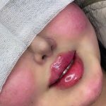 مرکز زیبایی الماس تبریز