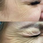 مرکز زیبایی الماس تبریز