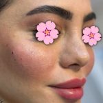 مرکز زیبایی الماس تبریز