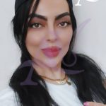 کلینیک کاشت ابرو و مو آراویرا پاسداران تهران
