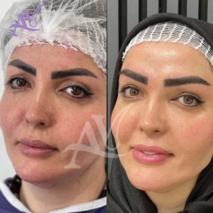 کلینیک کاشت ابرو و مو آراویرا پاسداران تهران-مشاغل ممتاز