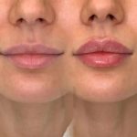 کلینیک زیبایی لونا در اسلامشهر