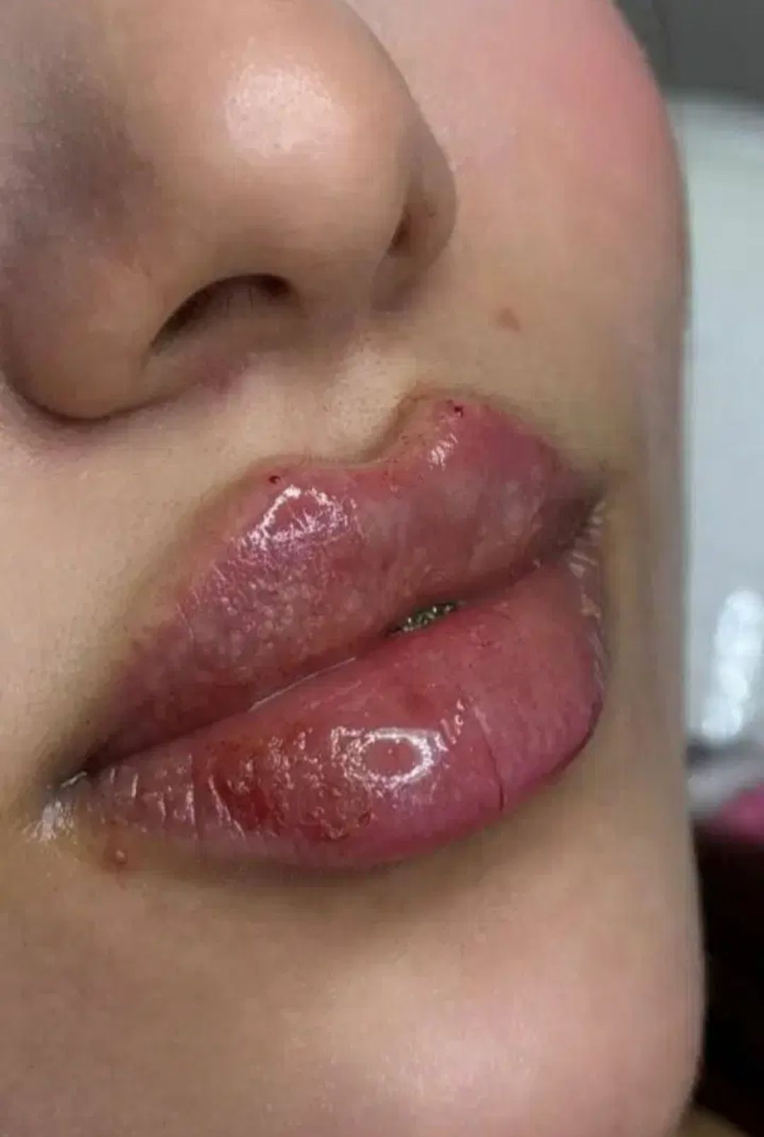 خدمات زیبایی صورت در کلینیک زیبایی لونا اسلامشهر -مشاغل ممتاز