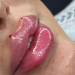 کلینیک زیبایی لونا در اسلامشهر