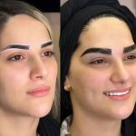 کلینیک زیبایی لونا در اسلامشهر