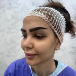 کلینیک زیبایی لونا در اسلامشهر