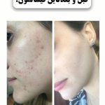 کلینیک درمان بیماری ناخن پادینا در قزوین
