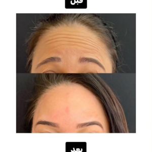 کلینیک درمان بیماری ناخن پادینا در قزوین درمان تخصصی قارچ ناخن پا -مشاغل ممتاز