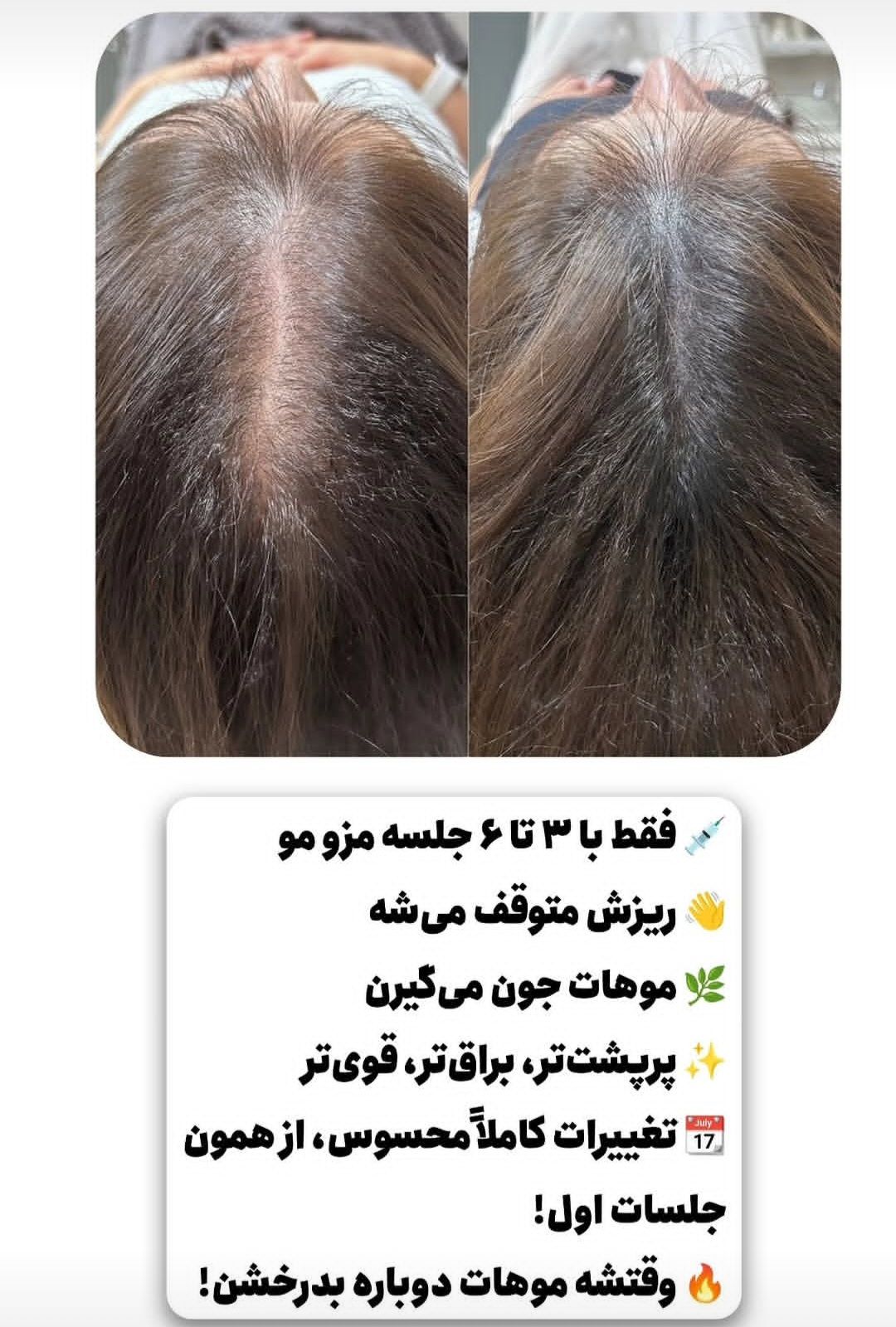خدمات مو پادینا در قزوین -مشاغل ممتاز 
